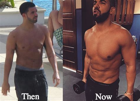 drake plastic surgery before and after